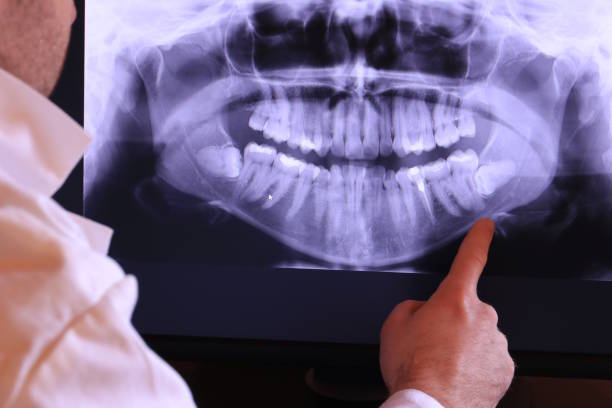 Best Emergency Gum Treatment in Seven Corners, VA