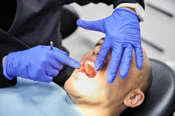 Best Emergency Tooth Extraction in Seven Corners, VA
