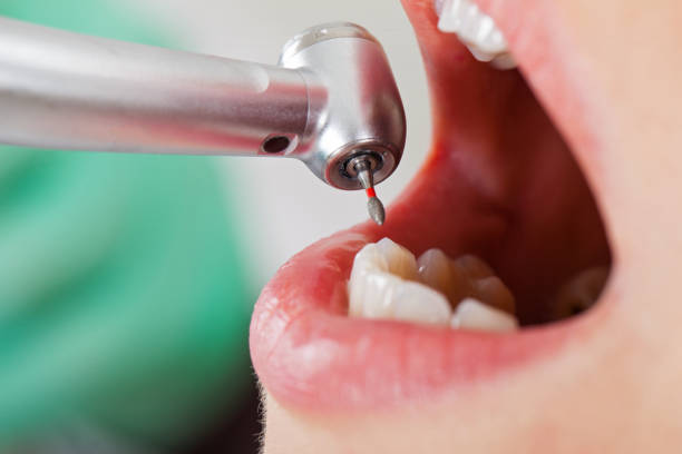 Best Weekend Emergency Dentist in Seven Corners, VA